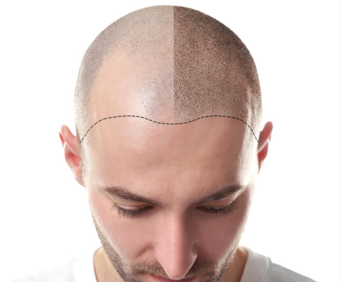 hairtatoo